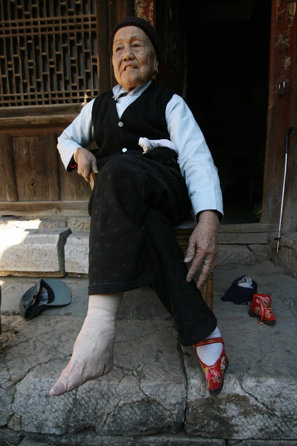 бинтование ног в древнем китае золотой лотос